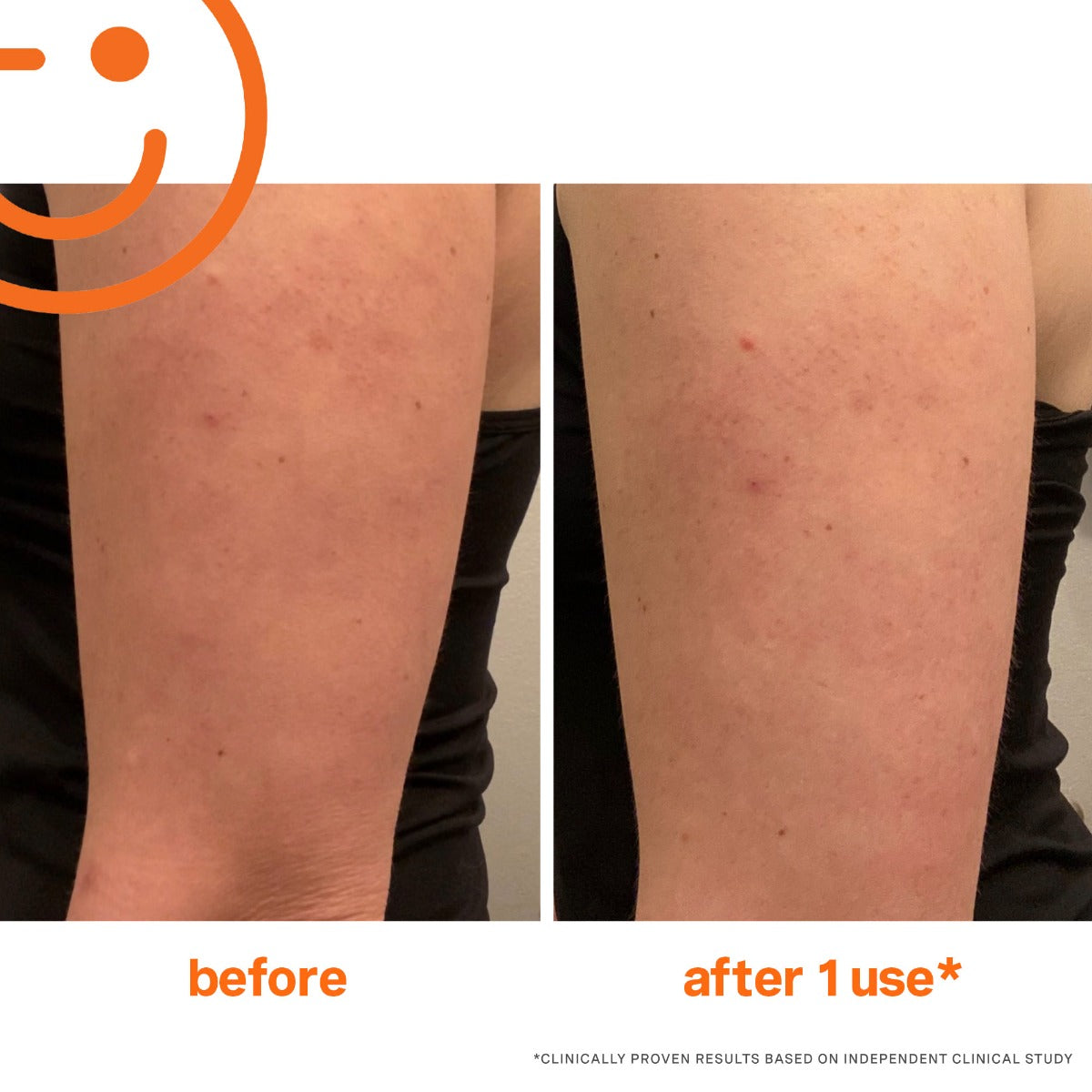 Kate Somerville ExfoliKate Resurfacing Body Scrub