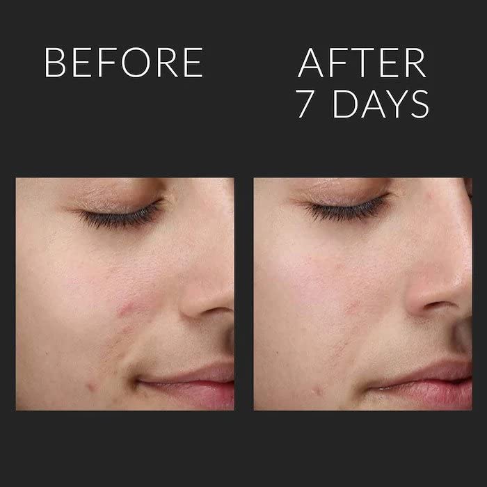 Kate Somerville Liquid ExfoliKate Triple Acid Resurfacing Treatment 120ml