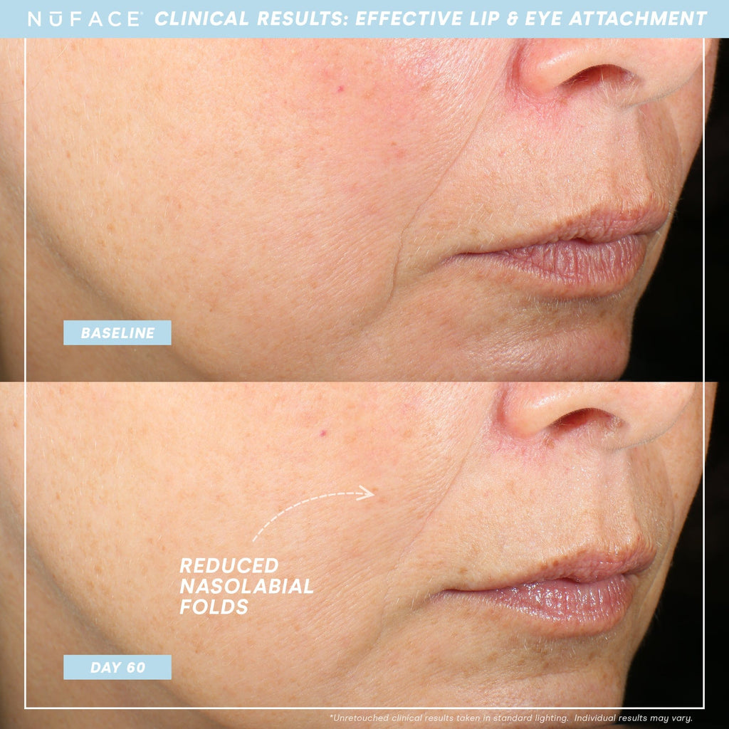 NuFACE TRINITY+ Lip & Eye Attachment