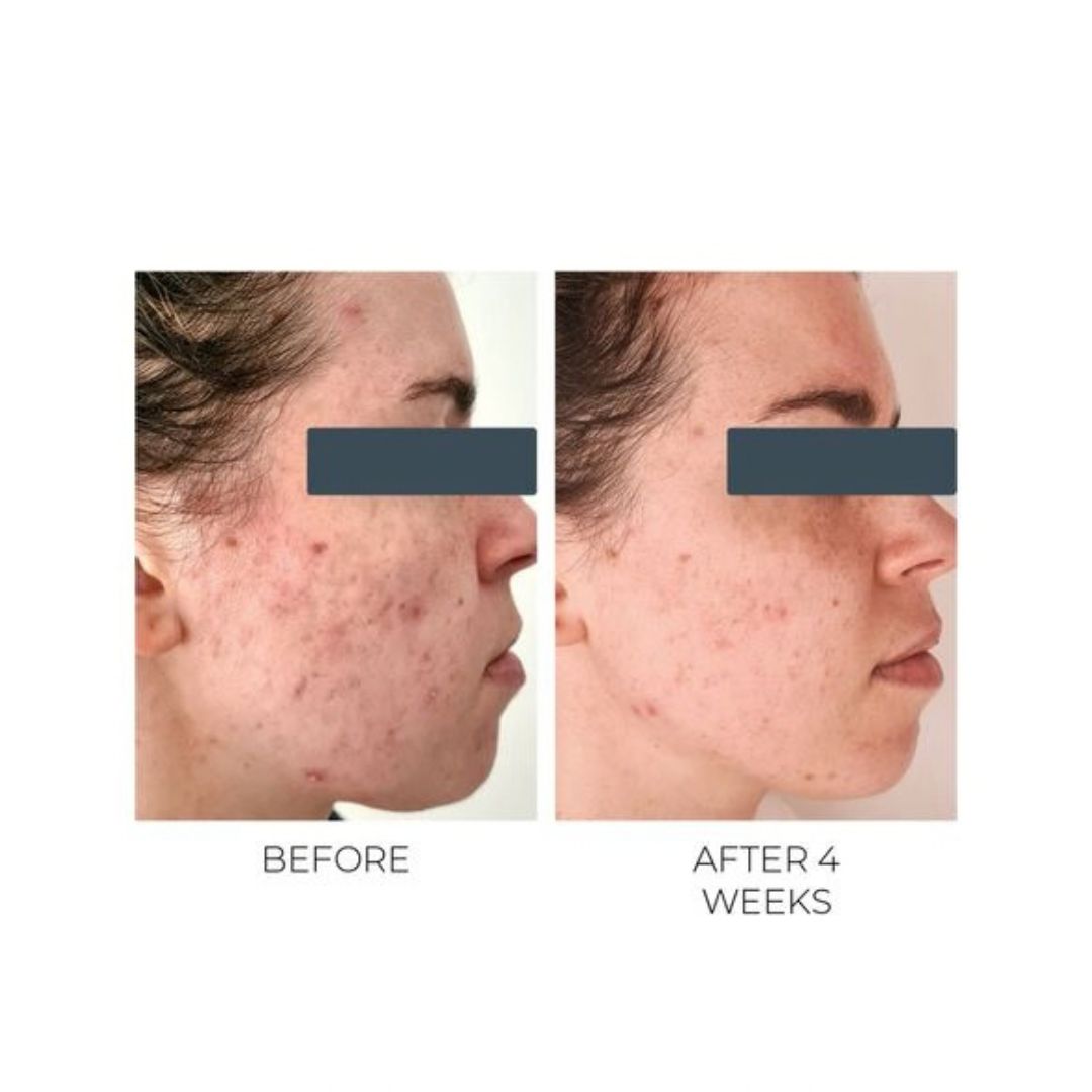 Violet Water D-Spot Clearing Blemish Treatment 20ml