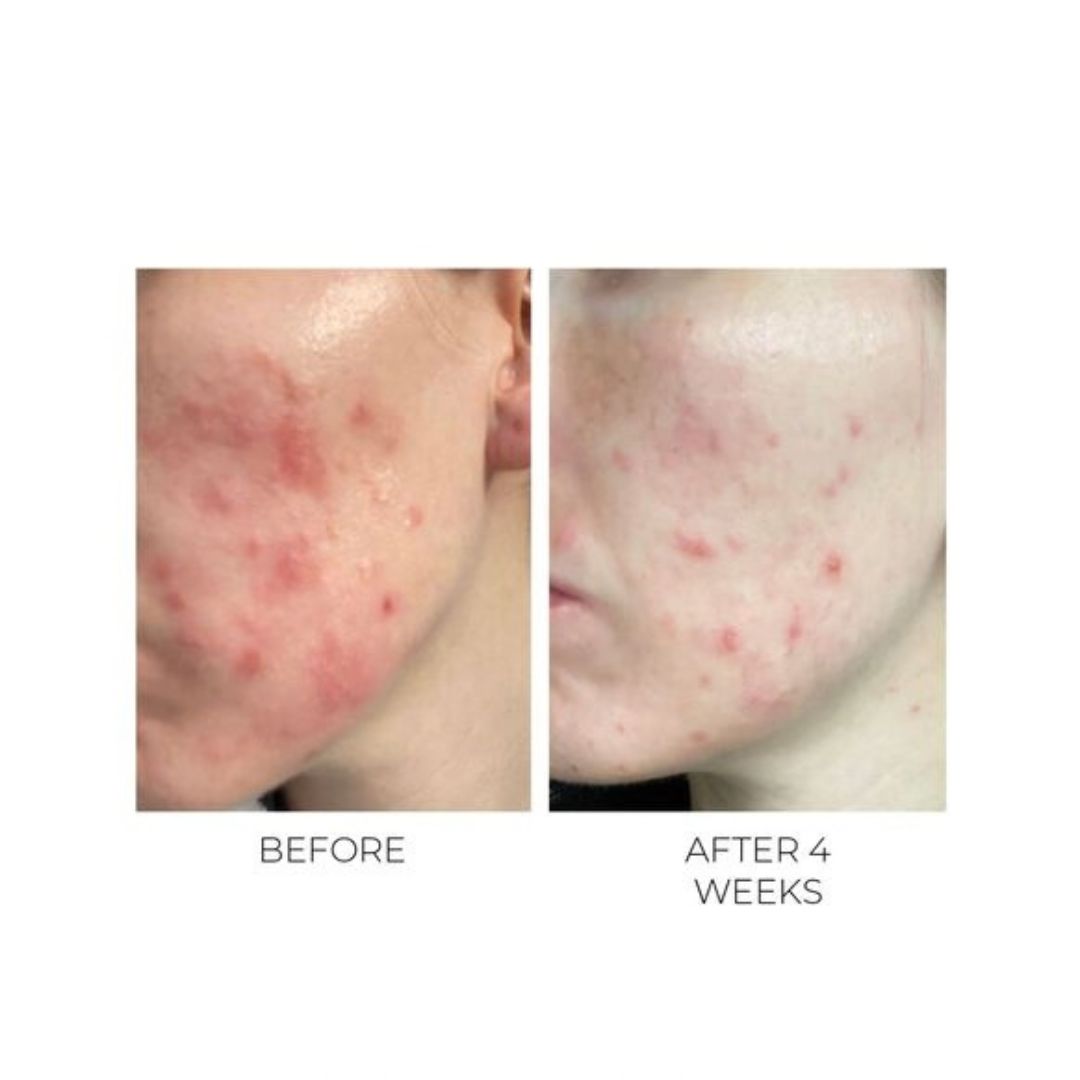 Violet Water D-Spot Clearing Blemish Treatment 20ml