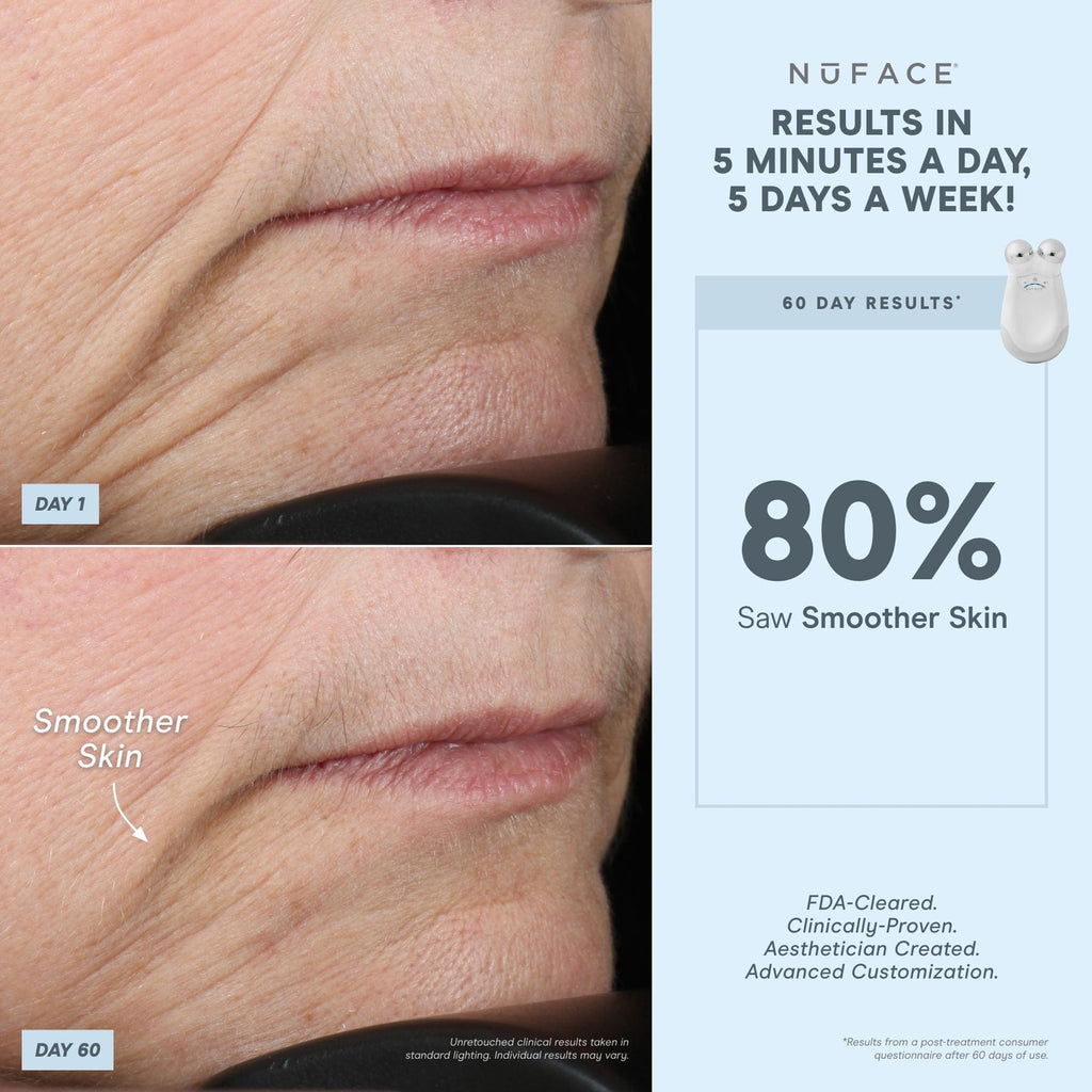 NuFACE Trinity Pro Facial Toning Device