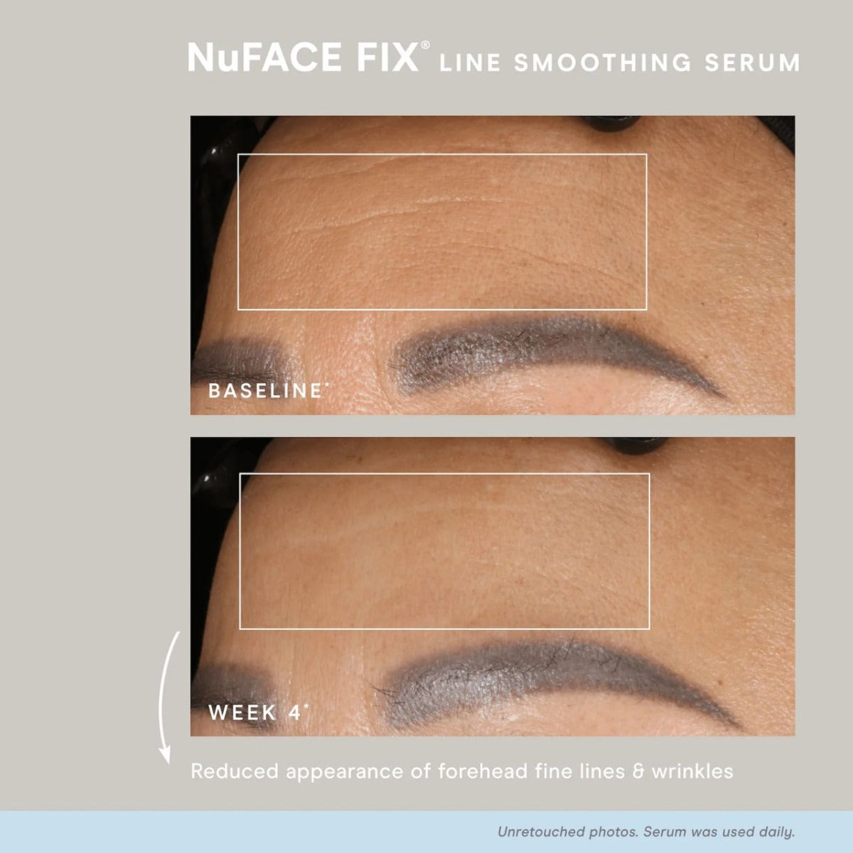 Nuface FIX Serum .5 oz