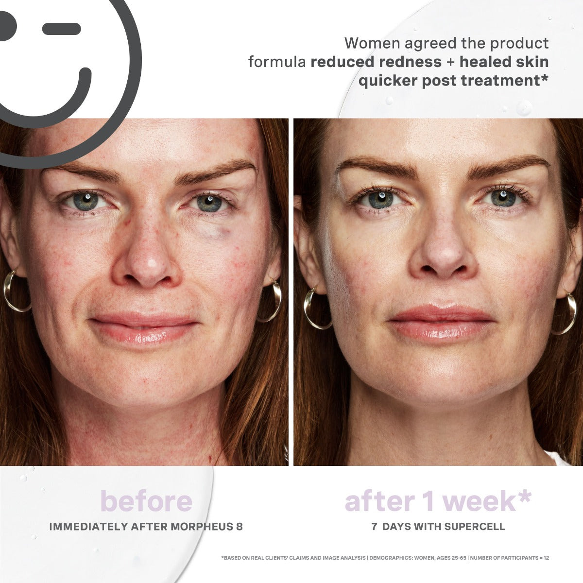 Kate Somerville Kateceuticals Supercell Rejuvenation Serum