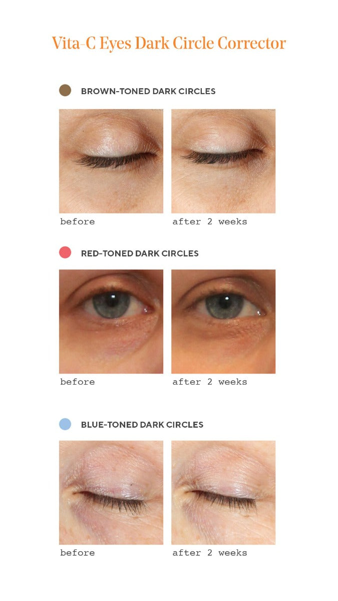 Murad Vita-C Eyes Dark Circle Corrector 15ml