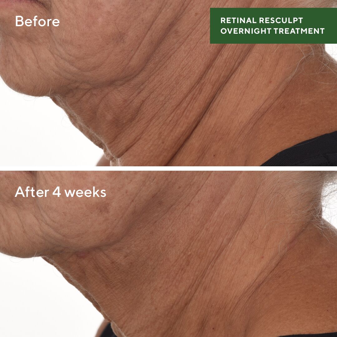 Retinal Resculpt Overnight Treatment 30ml