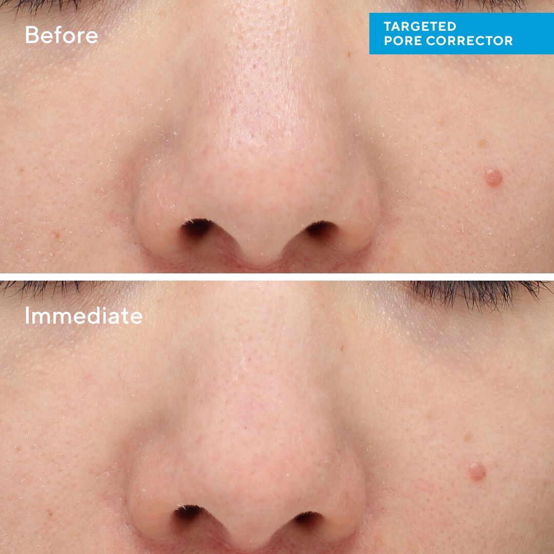 Murad Targeted Pore Corrector 15ml