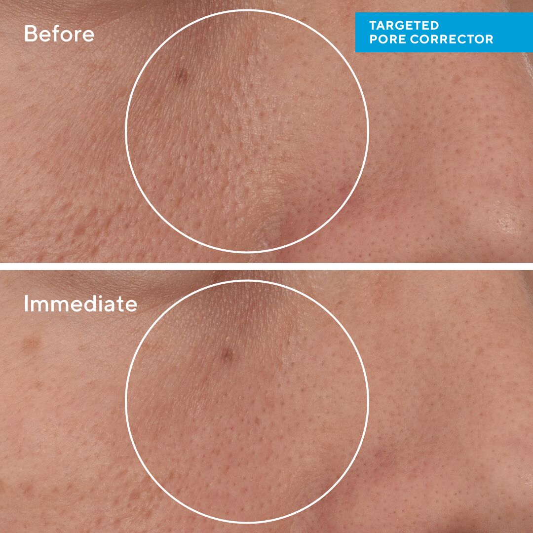 Murad Targeted Pore Corrector 15ml