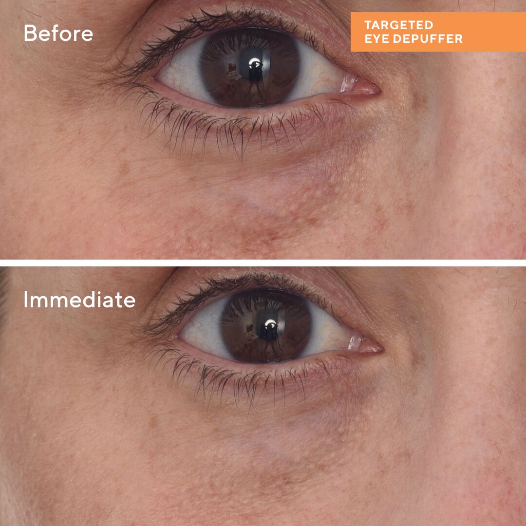 Targeted Eye Depuffer 15ml