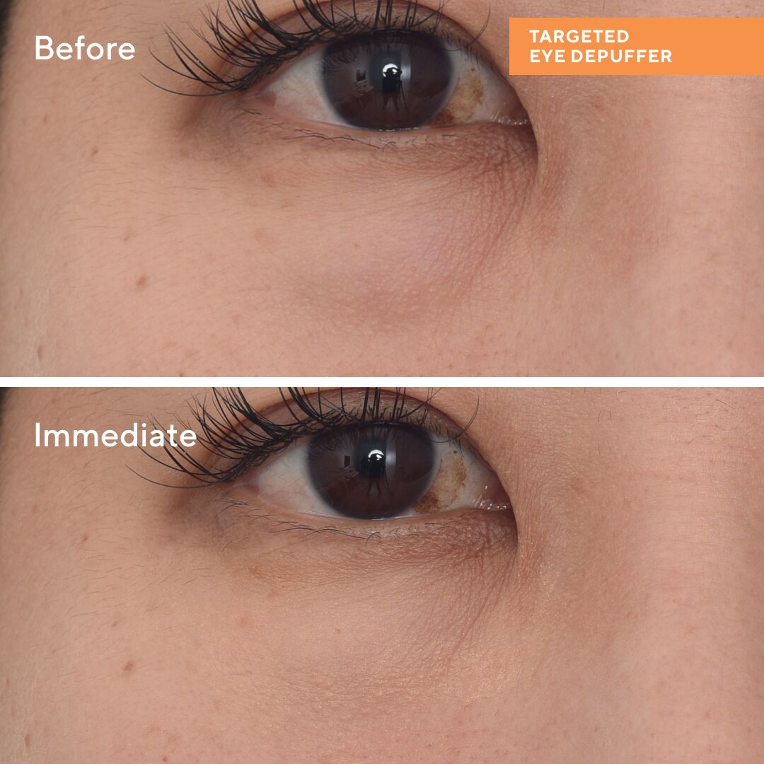 Targeted Eye Depuffer 15ml