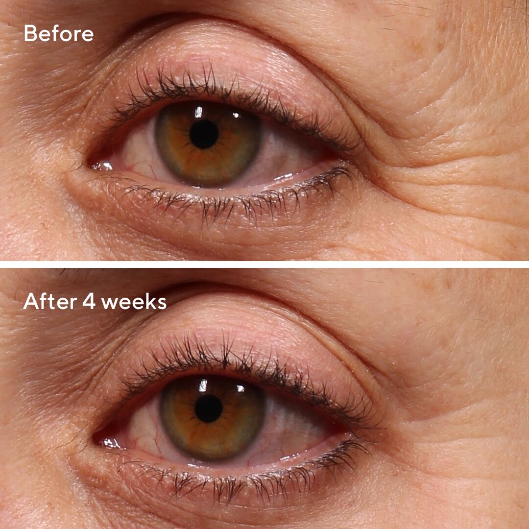 Retinol Youth Renewal Eye Serum 15ml