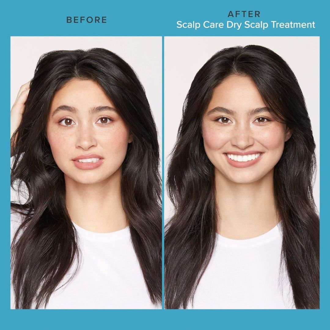 LIVING PROOF Scalp Care Dry Scalp Treatment