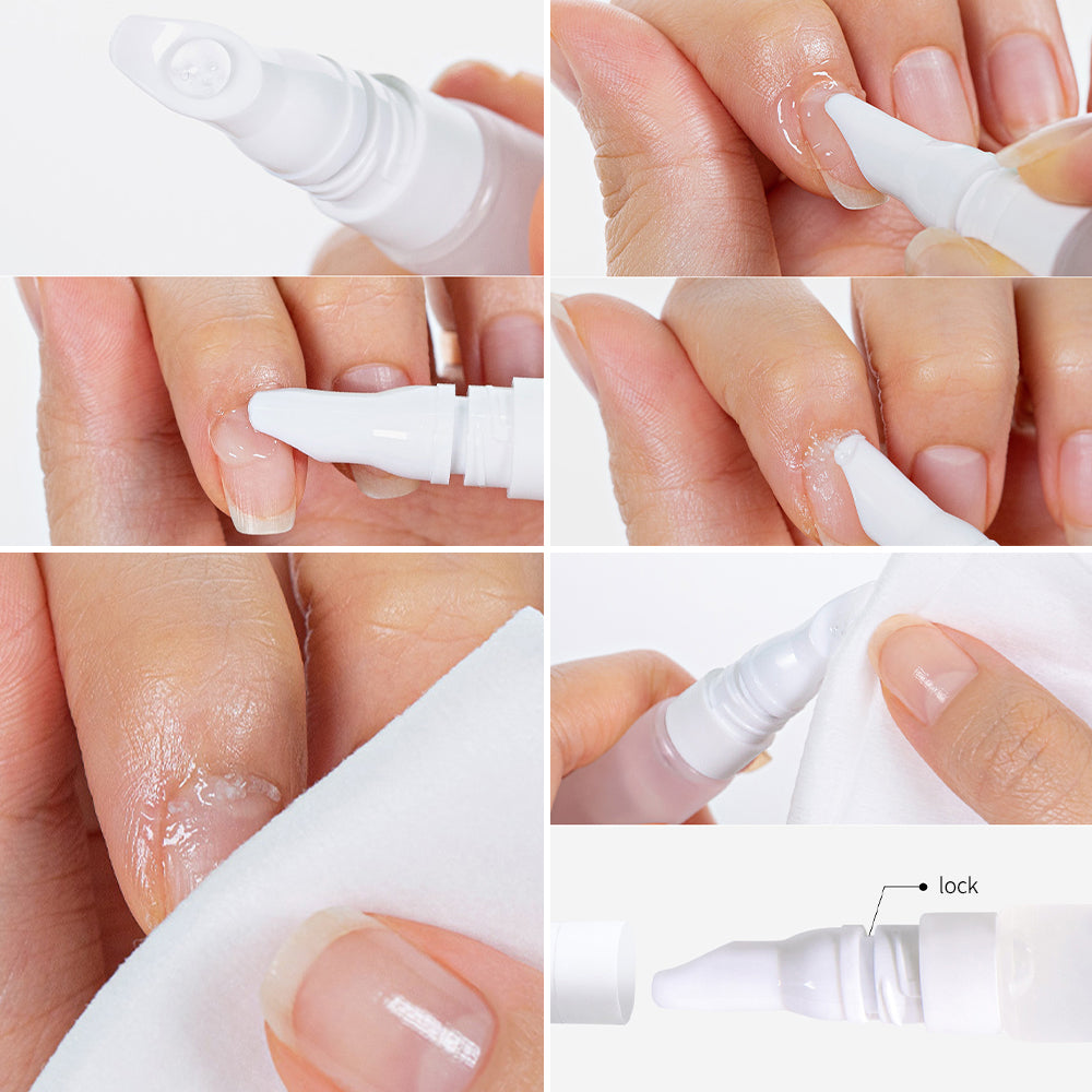 Ohora Pro Loose Skin Remover_10G