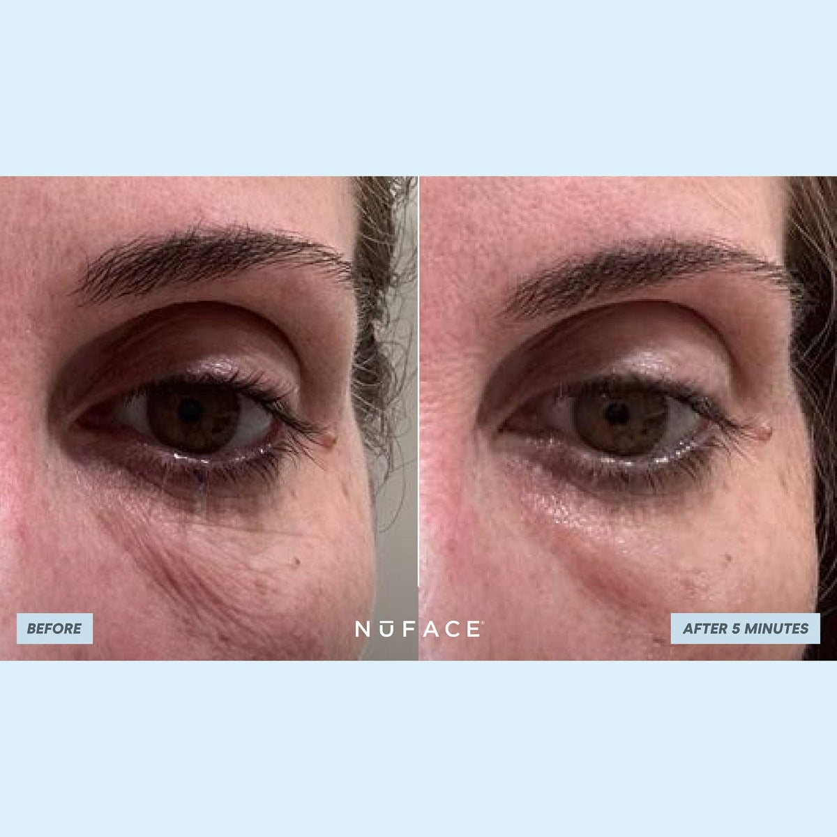 NuFACE IonPlex® Hydra-Gel Power Patches (30 pairs eye patches)