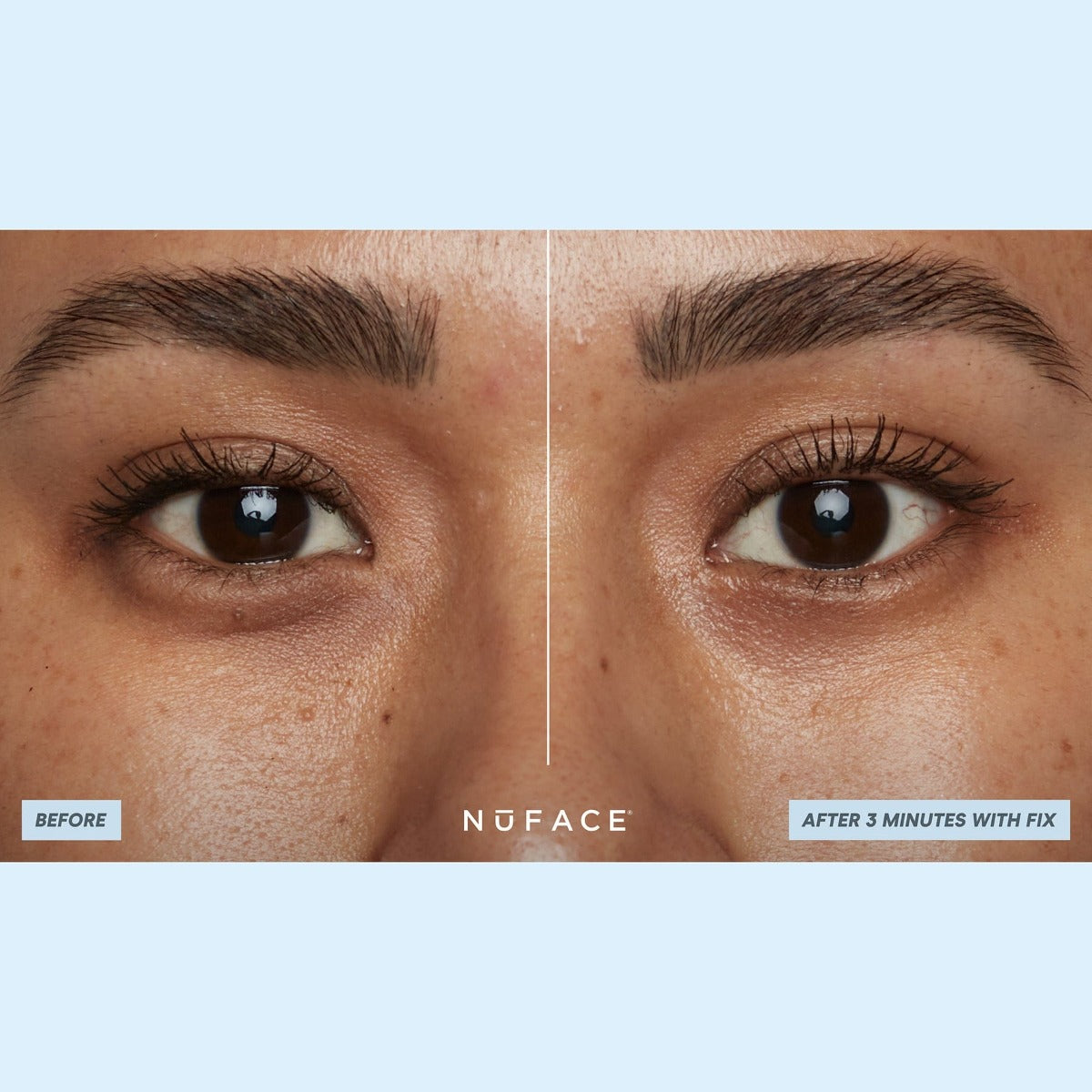 NuFACE IonPlex® Hydra-Gel Power Patches (30 pairs eye patches)