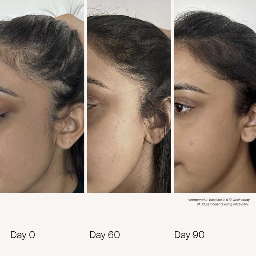 Living Proof Scalp Care Density Serum 50ml